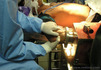 Травматология. Шокирующие фото - извлечение руки из мясорубки